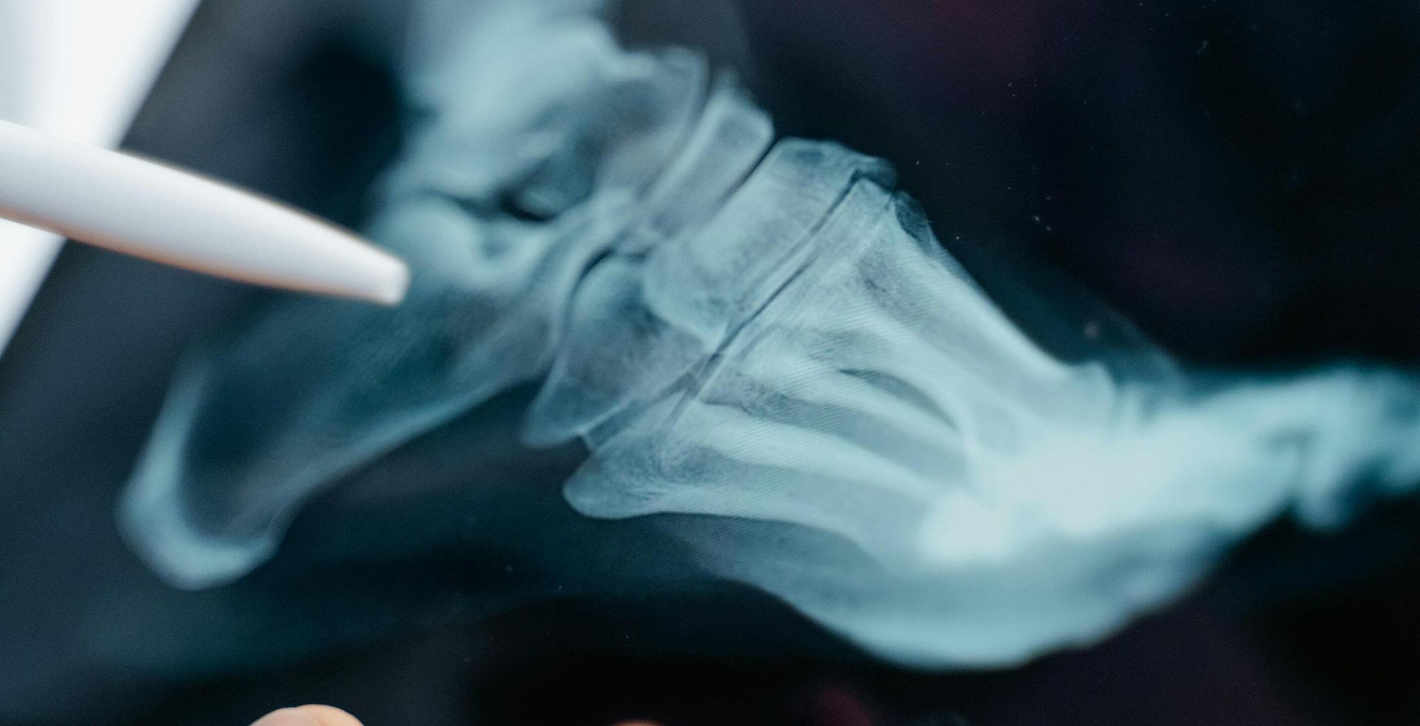 Healthcare 2 min Close-up of a hand and wrist X-ray with a stylus pointing at the bones